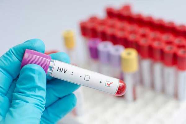 بحث عن فيروس hiv