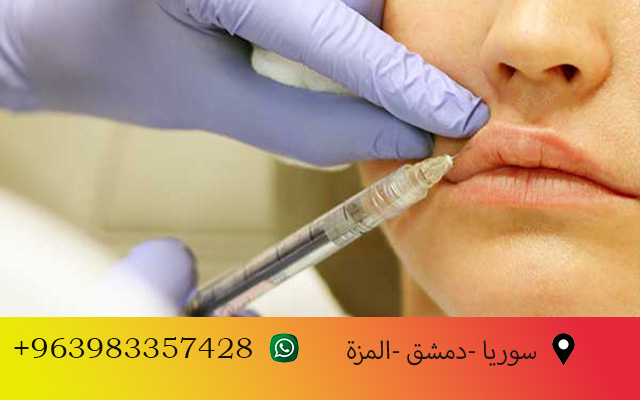 البوتكس والفيلر في سوريا 2025: دليلك الشامل للحصول على إطلالة شابة بأفضل الأسعار